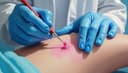 biopsy — биопсия