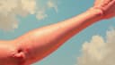 I have a rash on my skin — Ich habe einen Hautausschlag