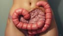 estreñimiento — constipation