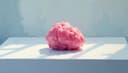 tumor — Tumor