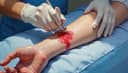 wound — Wunde