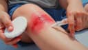 la blessure — wound