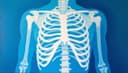 la radiographie — X-ray