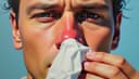 J'ai le nez qui coule — I have a runny nose