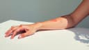 J'ai une éruption cutanée — I have a rash on my skin