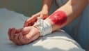 wound — Wunde